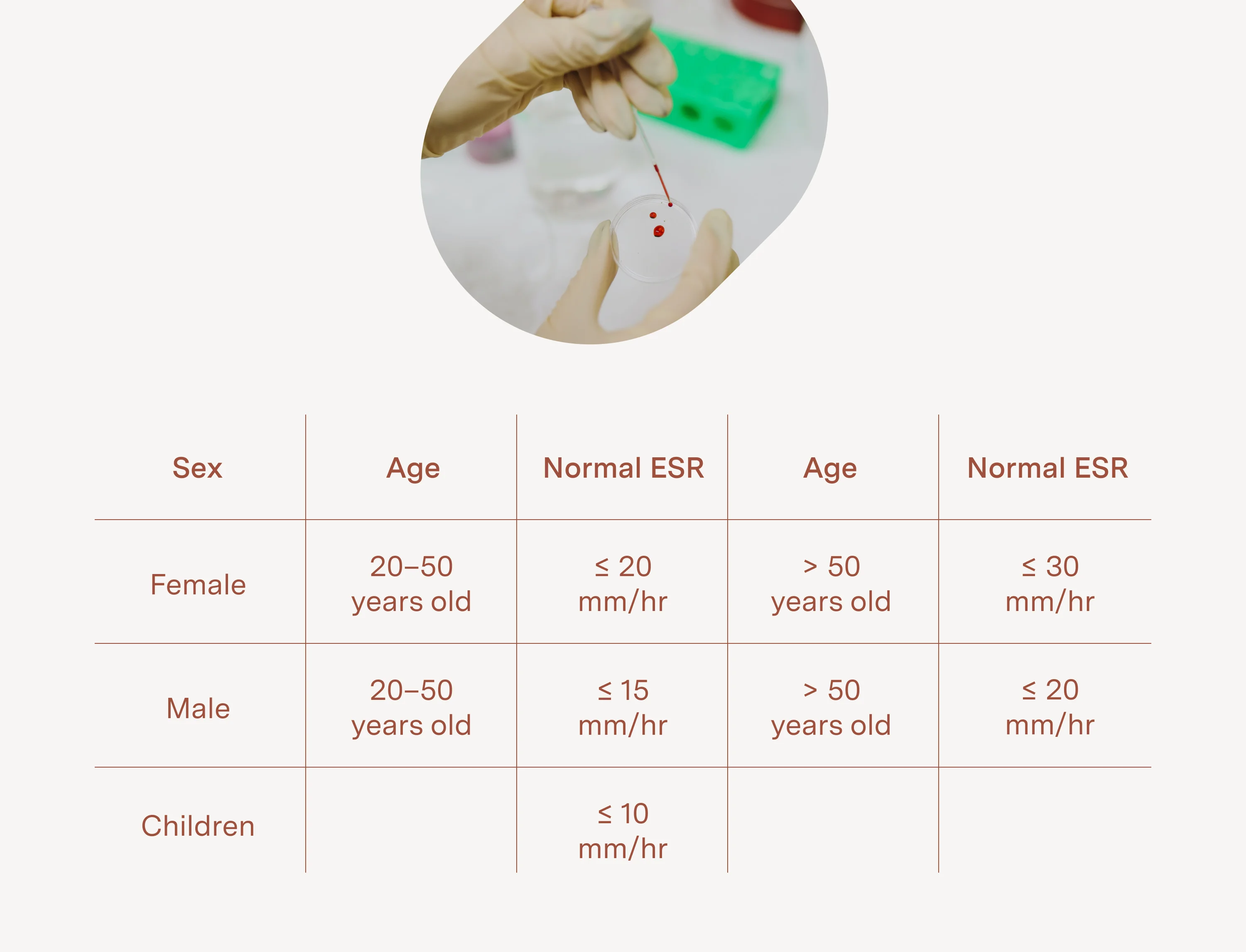 ESR rate table defining normal ranges 